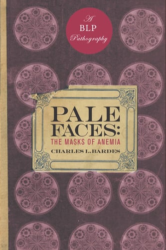 Pale Faces The Masks of Anemia